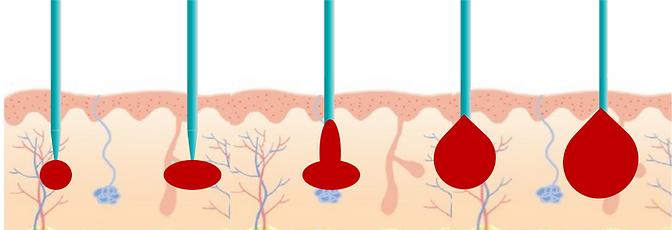 Non-insulated electrodes